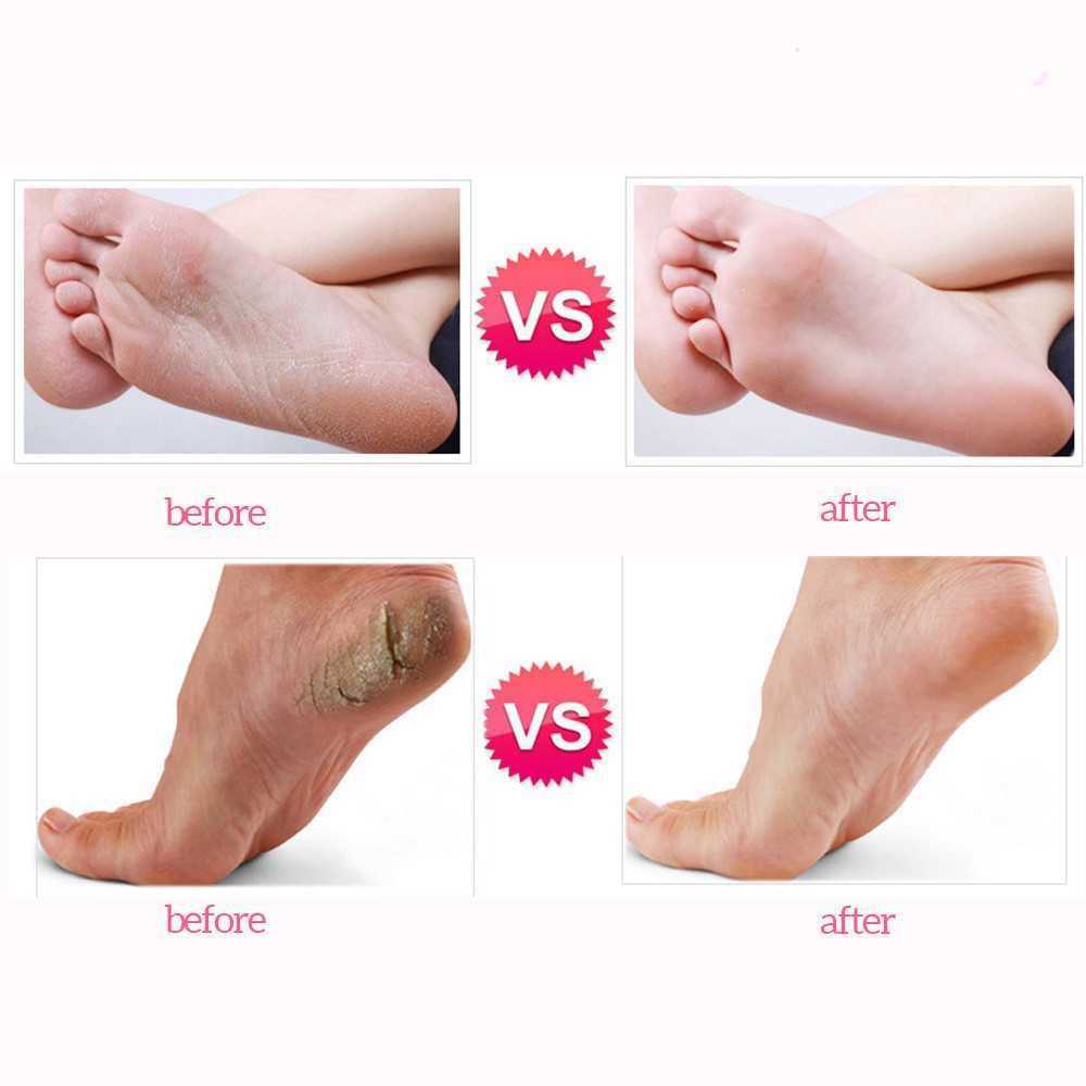 เครื่องขัดเท้าไฟฟ้า ที่ขัดส้นเท้าแตก ปรับความแรงได้ พร้อมแผ่นขัด60แผ่น