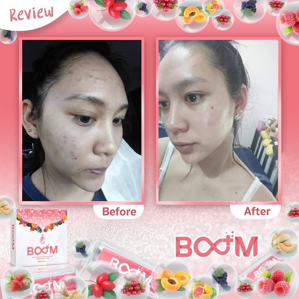 บลูม คอลลาเจน พลัส BOOM COLLAGEN PLUS