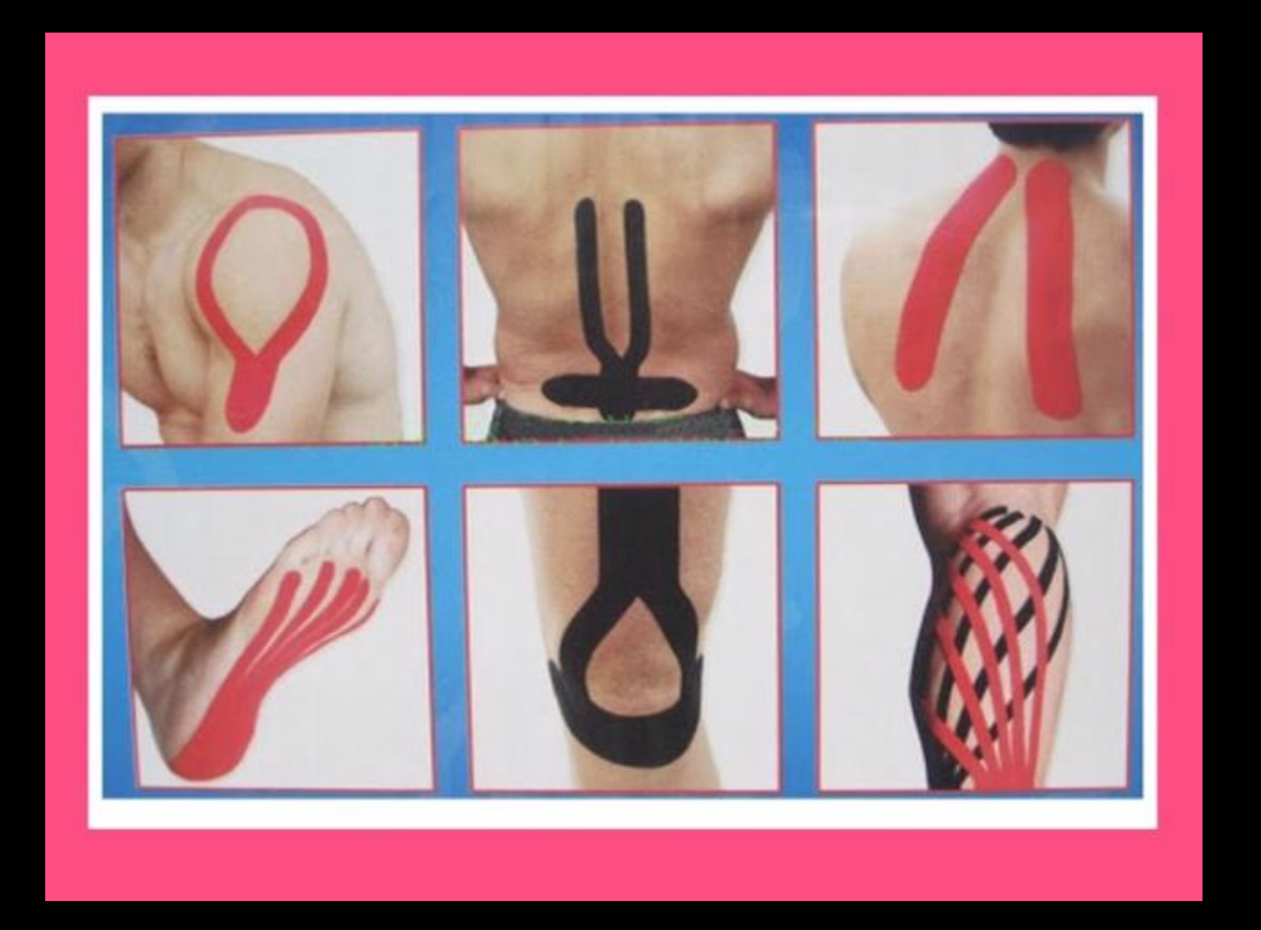 kinesiology tape - เทปบำบัด,เทปลดอาการเจ็บปวดให้นักกีฬา