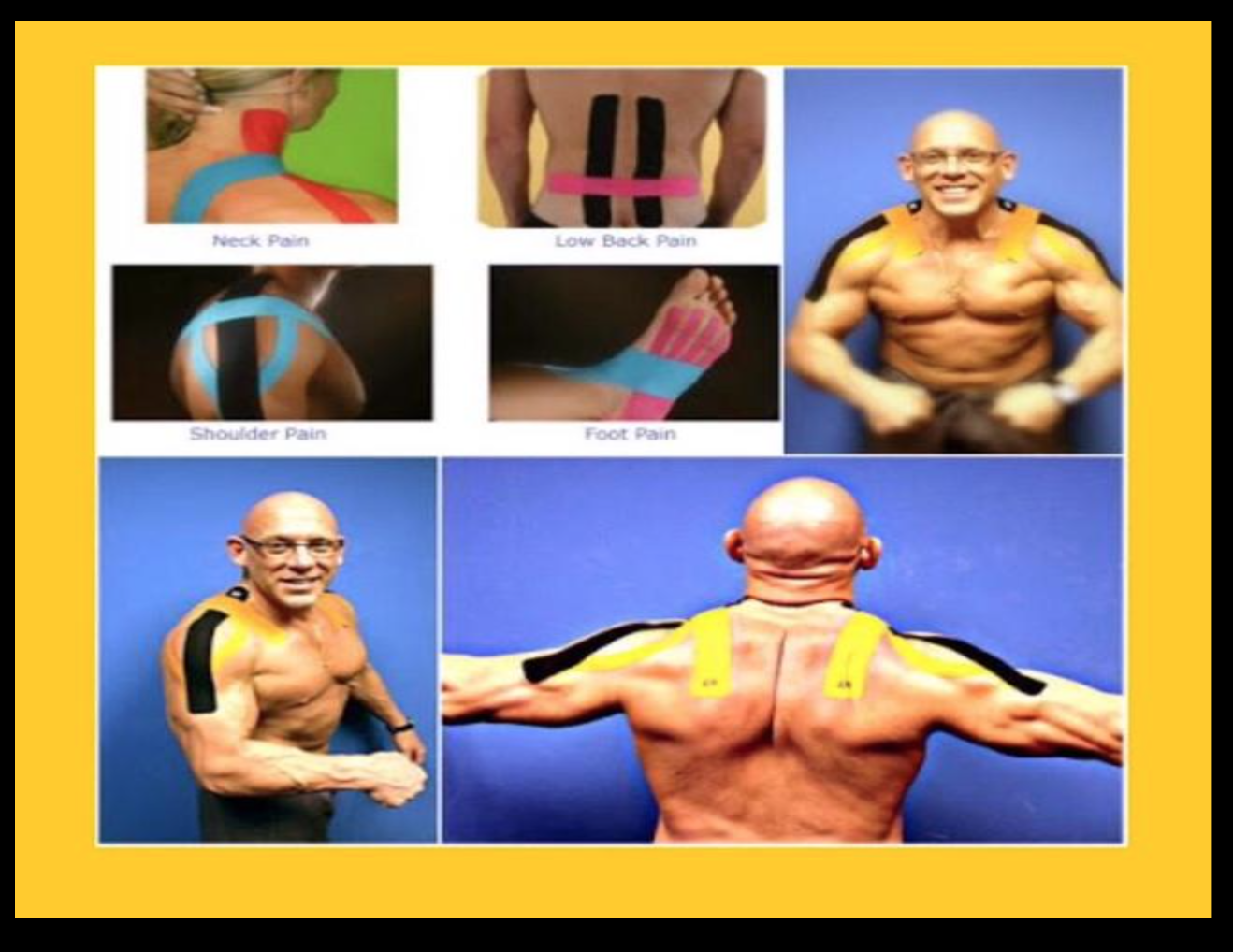 kinesiology tape - เทปบำบัด,เทปลดอาการเจ็บปวดให้นักกีฬา