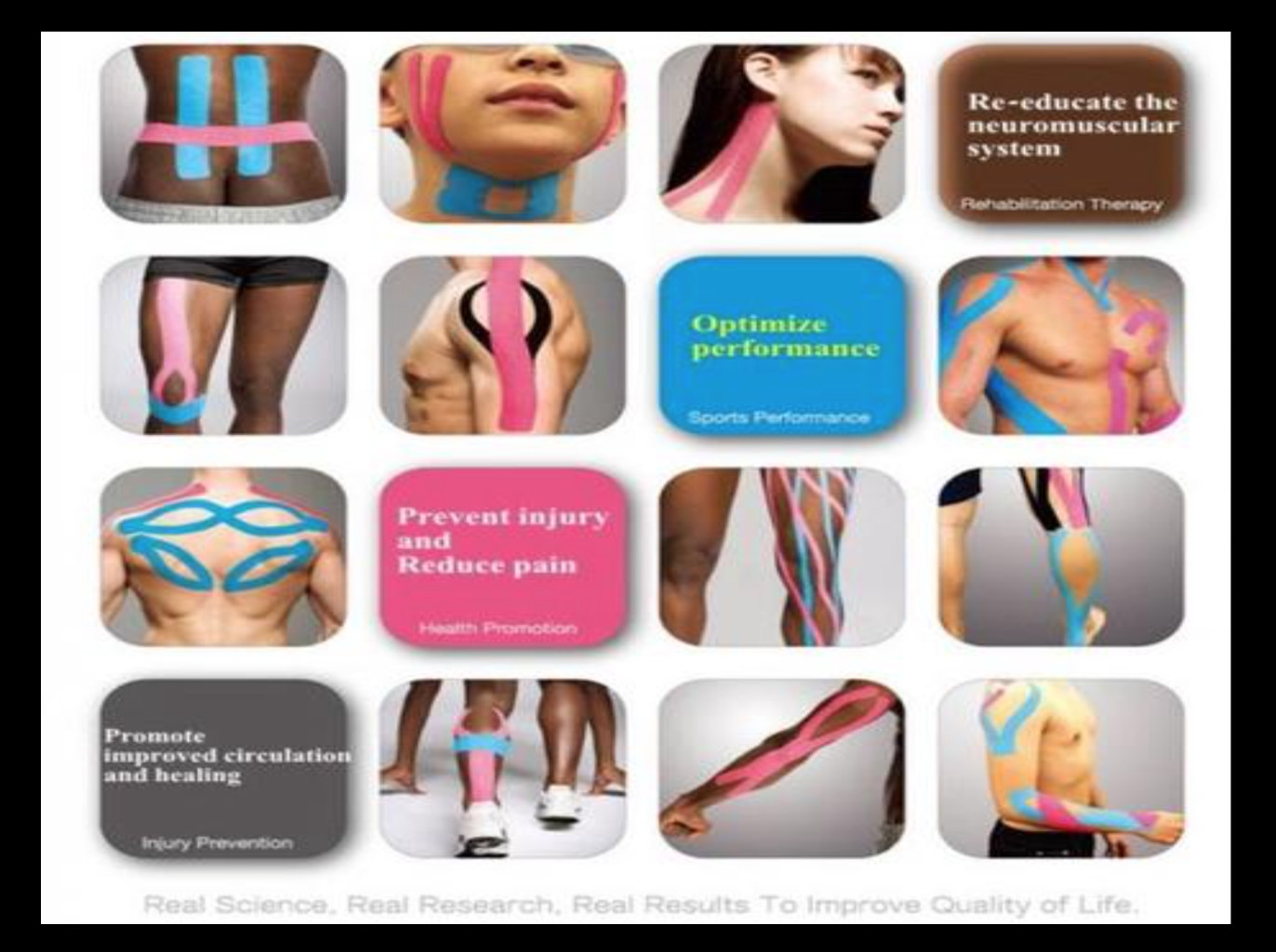 kinesiology tape - เทปบำบัด,เทปลดอาการเจ็บปวดให้นักกีฬา
