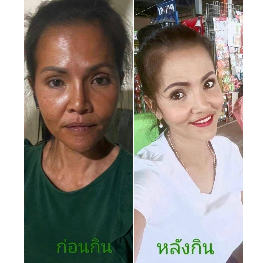 เบอร์รี่ เอส Berry S ล้างสารพิษ สารตกค้าง ในเลือด