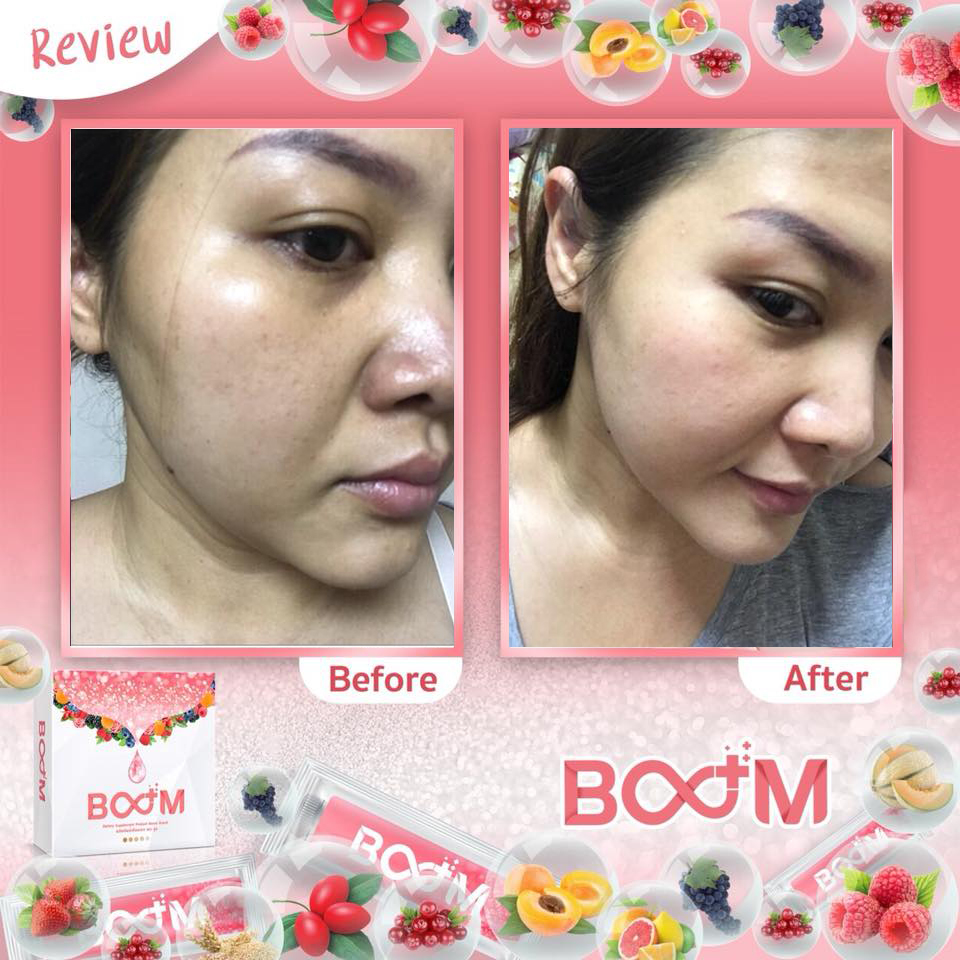 บลูม คอลลาเจน พลัส BOOM COLLAGEN PLUS