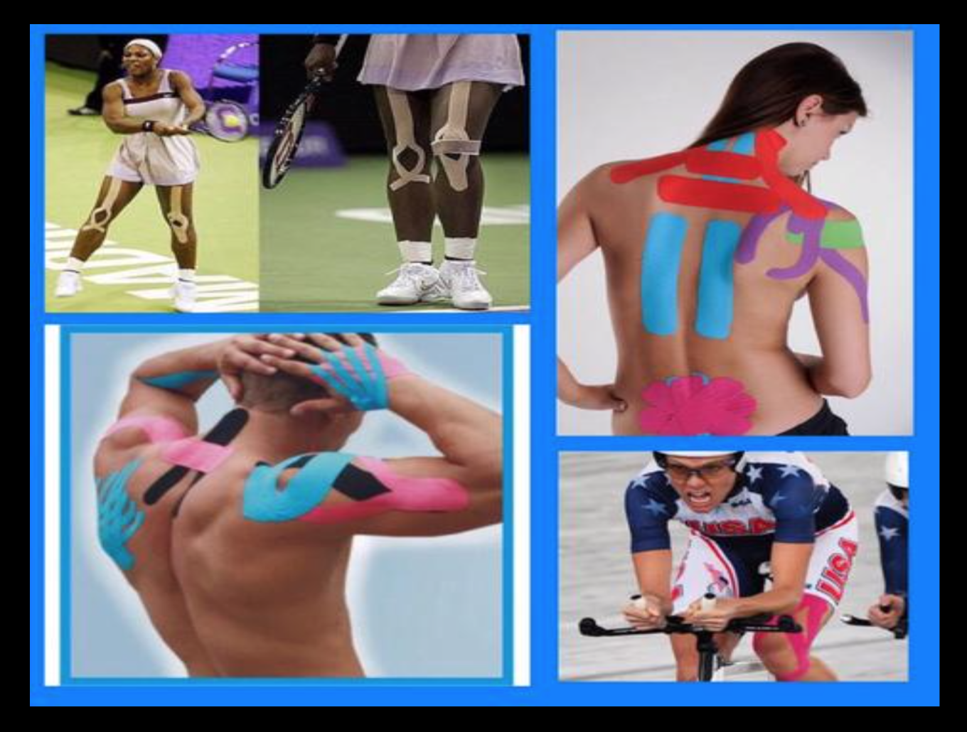 kinesiology tape - เทปบำบัด,เทปลดอาการเจ็บปวดให้นักกีฬา