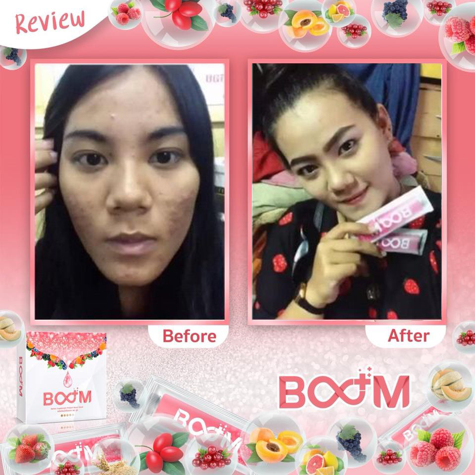 บลูม คอลลาเจน พลัส BOOM COLLAGEN PLUS