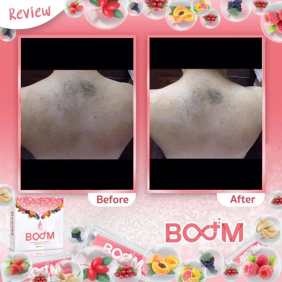 บลูม คอลลาเจน พลัส BOOM COLLAGEN PLUS