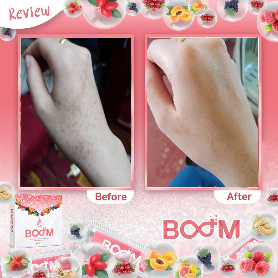 บลูม คอลลาเจน พลัส BOOM COLLAGEN PLUS