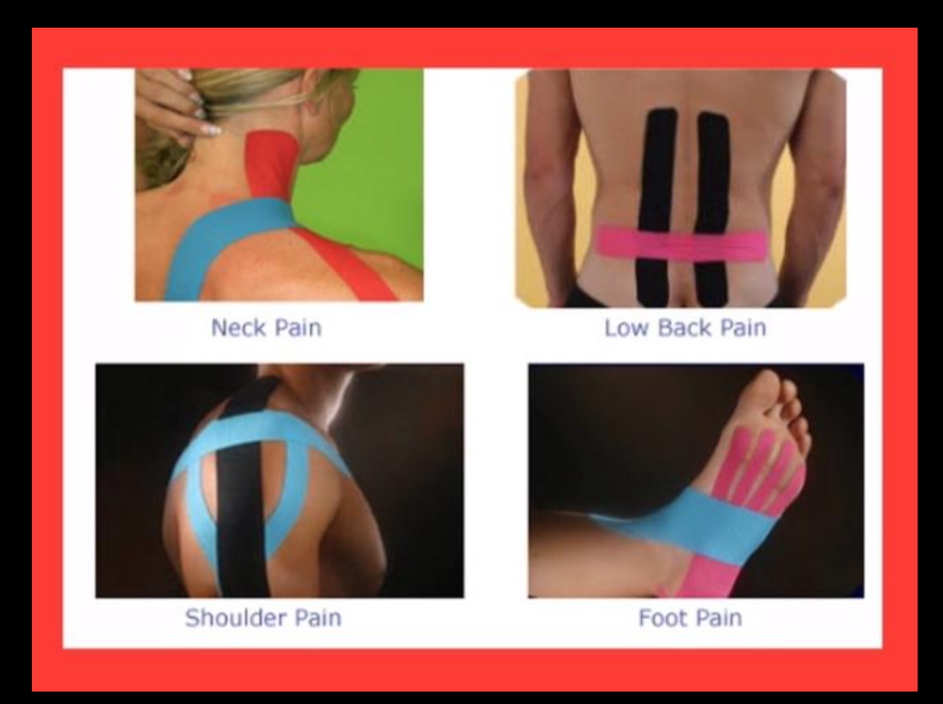 kinesiology tape - เทปบำบัด,เทปลดอาการเจ็บปวดให้นักกีฬา