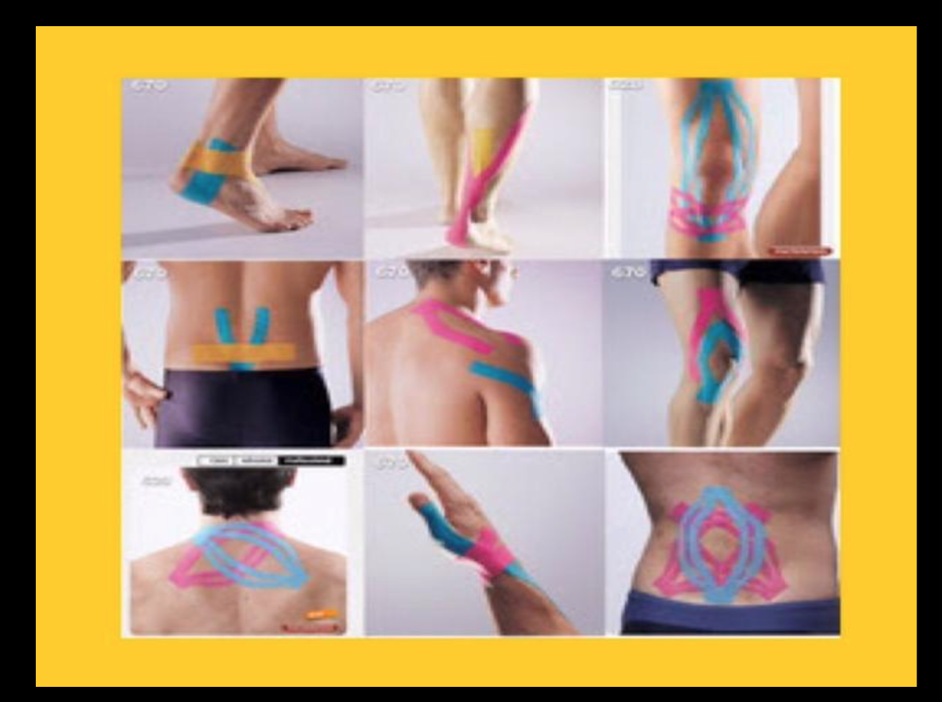 kinesiology tape - เทปบำบัด,เทปลดอาการเจ็บปวดให้นักกีฬา