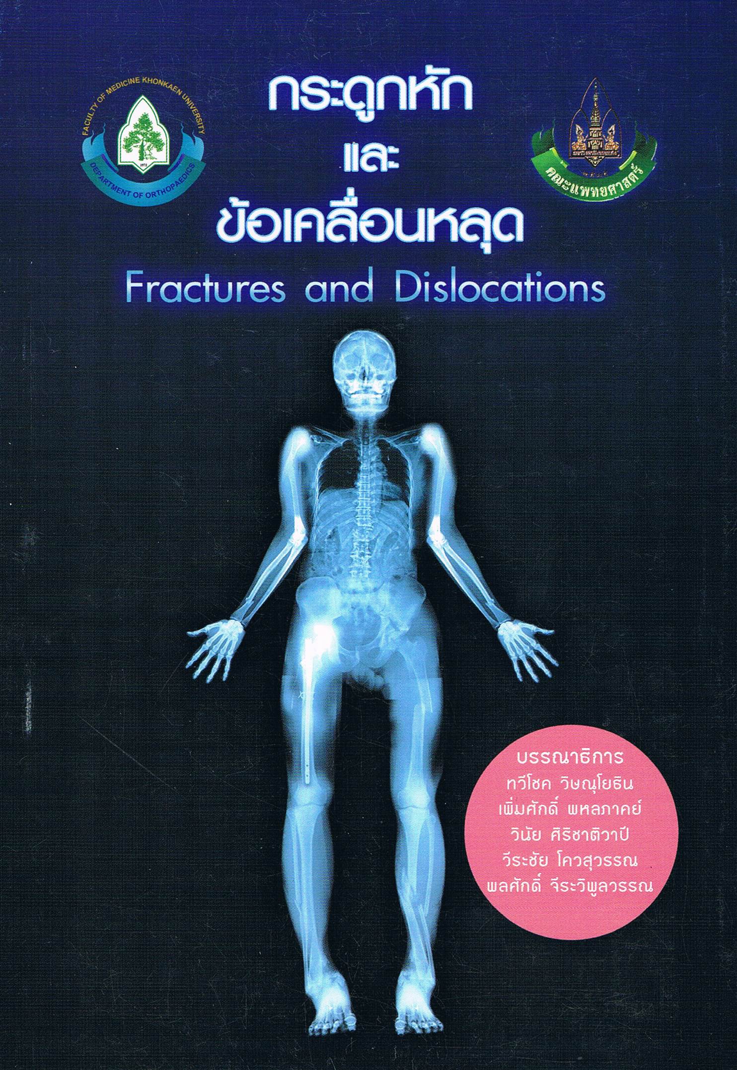 กระดูกหักและข้อเคลื่อนหลุด (Fractures and Dislocations)