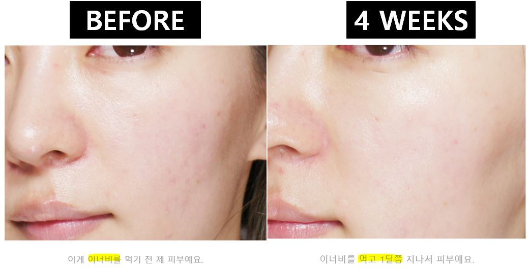 (พรีออเดอร์รอของ 10-14 วัน ) Inner B Collagen อินเนอร์บีคลอลาเจน ช่วยให้ผิวเด้ง อิ่มน้ำสุดๆ ช่วยลดจุดด่างดำ กระชับรูขุมขน สั่งเยอะเกิน 6 กระปุ๊กมีแถมฟรีคะ