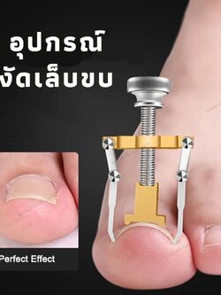 ที่งัดเล็บขบ อุปกรณ์งัดเล็บขบ ตัวช่วยง้างรักษาเล็บขบ